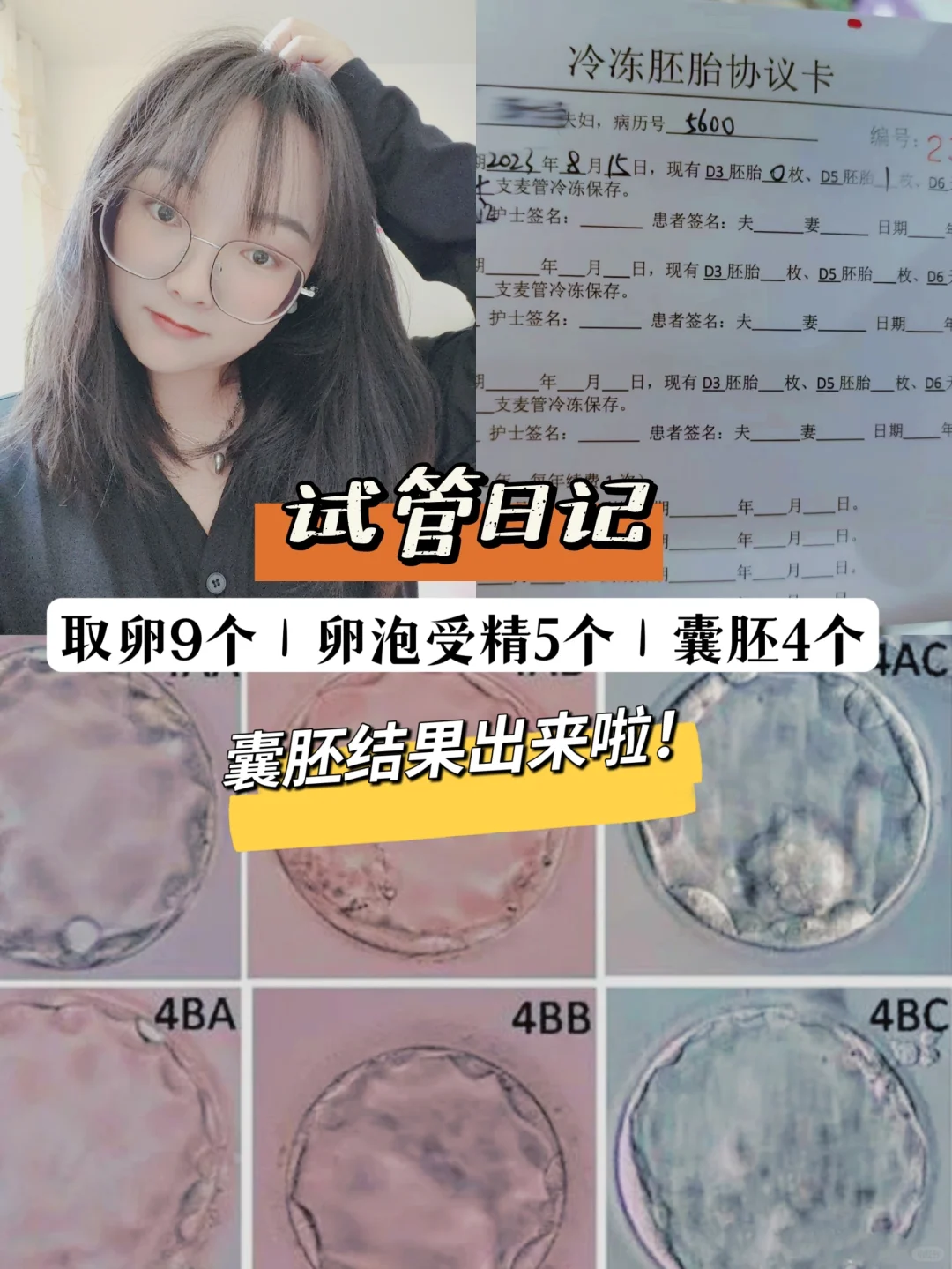 <b>试管日记｜一分钟教会你看胚胎等级‼️,代孕什么地方做的最权威-国内供卵最快的医院</b>