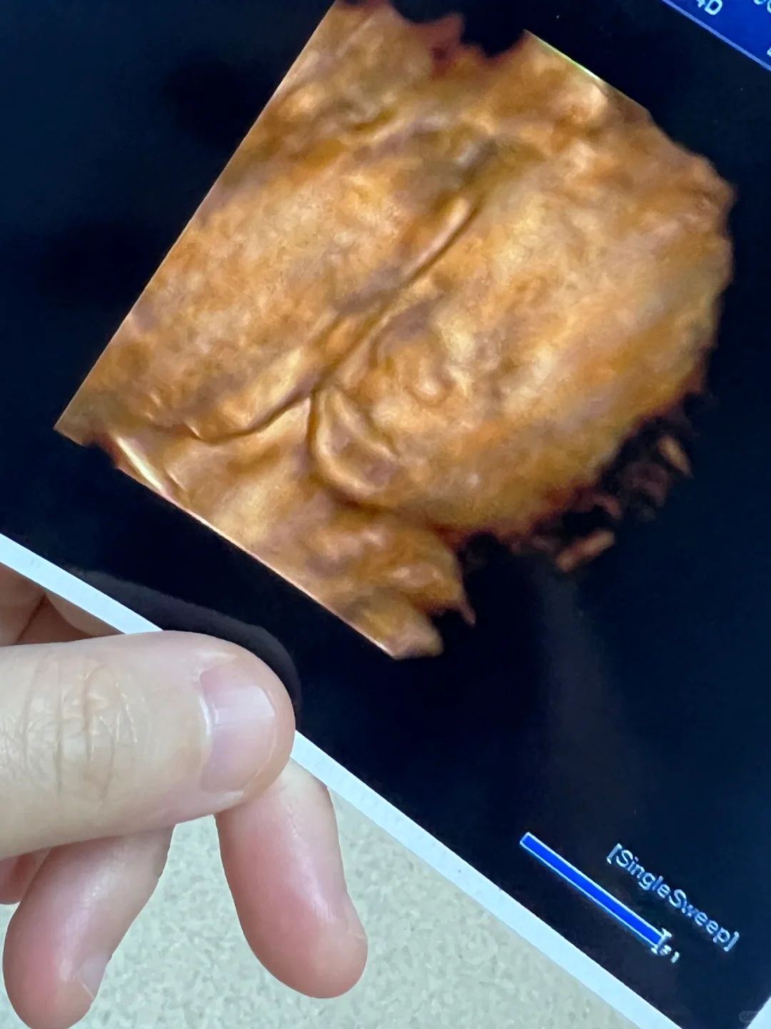 <b>大排畸一次过了，个个都说是男孩,找个女人 代孕</b>